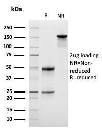 SDS-PAGE analysis of Anti-LSP1 Antibody [LSP1/3042] under non-reduced and reduced conditions; showing intact IgG and intact heavy and light chains, respectively. SDS-PAGE analysis confirms the integrity and purity of the antibody.