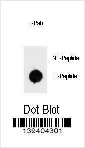 Anti-BAD Rabbit Polyclonal Antibody (PE (Phycoerythrin))