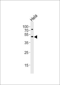 Anti-VPS4A Rabbit Polyclonal Antibody