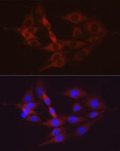 Immunofluorescence analysis of PC-12 cells using Anti-Hexokinase II Antibody (A12752) at a dilution of 1:100 (40x lens). DAPI was used to stain the cell nuclei (blue).