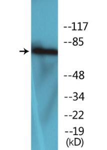 Western blot analysis of lysates from COLO205 cells using Anti-LIMK2 (phospho Thr505) Antibody