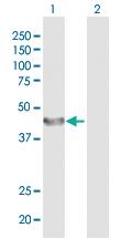 Anti-CDGIi, CMS14, CMSTA3, NET38, hALPG2 Rabbit Polyclonal Antibody