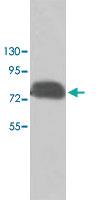 Anti-PAK6 Rabbit Polyclonal Antibody