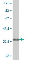 Anti-EPHA5 Mouse Monoclonal Antibody [clone: 6F4]