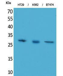 Antibody anti-BRMS1 A97678-100 100 µg