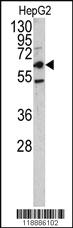 Anti-CELA3B Rabbit Polyclonal Antibody