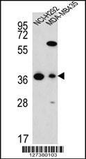 Anti-FAHD2A Rabbit Polyclonal Antibody (AP (Alkaline Phosphatase))