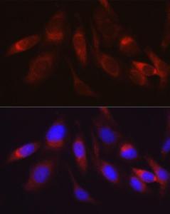 Immunofluorescence analysis of U2OS cells using Anti-Hexokinase II Antibody (A12752) at a dilution of 1:100 (40x lens). DAPI was used to stain the cell nuclei (blue).