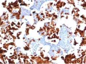 Immunohistochemical analysis of formalin-fixed, paraffin-embedded human bone marrow tissue using Anti-Myeloperoxidase Antibody [rMPO/6904]