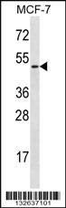 Anti-LAD1 Rabbit Polyclonal Antibody