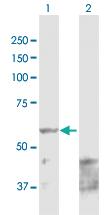 Anti-PPAT Rabbit Polyclonal Antibody