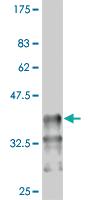 Anti-PBX1 Mouse Monoclonal Antibody [clone: 2D6]