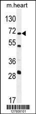 Anti-NT5C1B Rabbit Polyclonal Antibody (Biotin)