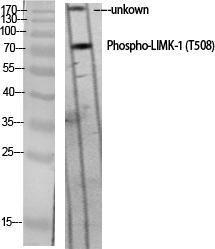 Western blot analysis of various cells using Anti-LIMK1 (phospho Thr508) Antibody