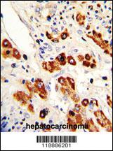 Anti-CEACAM Rabbit Polyclonal Antibody