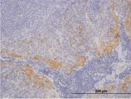 Anti-CK19 Mouse Polyclonal Antibody