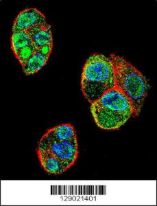 Anti-C9JLR9 Rabbit Polyclonal Antibody (HRP (Horseradish Peroxidase))