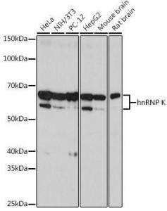 Western blot analysis of extracts of various cell lines, using Anti-hnRNP K Antibody [ARC0512] (A307298) at 1:2,000 dilution