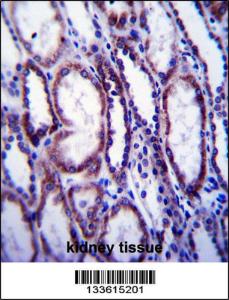 Anti-COL1A1 Rabbit Polyclonal Antibody (AP (Alkaline Phosphatase))