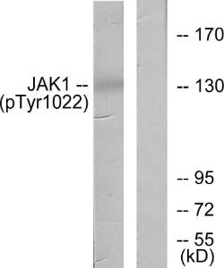 Western blot analysis of lysates from A549 cells using Anti-JAK1 (phospho Tyr1022) Antibody. The right hand lane represents a negative control, where the Antibody is blocked by the immunising peptide