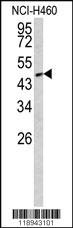 Anti-SMAD2 Rabbit Polyclonal Antibody