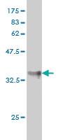 Anti-KLF11 Mouse Monoclonal Antibody [clone: 8F4]