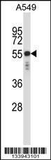 Anti-KRT6C Rabbit Polyclonal Antibody (FITC (Fluorescein Isothiocyanate))