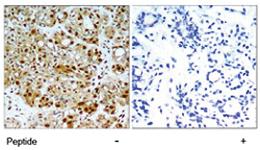 Anti-HSP90AB1 Rabbit Polyclonal Antibody