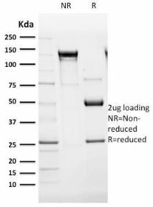 Anti-CD105 Mouse Monoclonal Antibody [clone: ENG/1621]