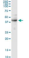 Anti-CDGIi, CMS14, CMSTA3, NET38, hALPG2 Rabbit Polyclonal Antibody