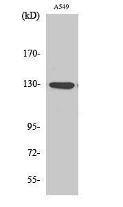 Western blot analysis of A549 cells using Anti-JAK1 (phospho Tyr1022) Antibody