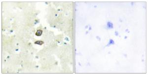 Immunohistochemical analysis of paraffin-embedded human brain tissue using Anti-BRI3B Antibody The right hand panel represents a negative control, where the antibody was pre-incubated with the immunising peptide