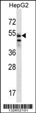 Anti-SLC29A3 Rabbit Polyclonal Antibody