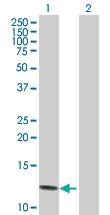 Anti-PPBP Mouse Polyclonal Antibody