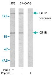 Anti-IGF1R Rabbit Polyclonal Antibody