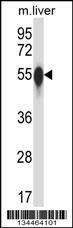 Anti-CSNK1G3 Rabbit Polyclonal Antibody (HRP (Horseradish Peroxidase))