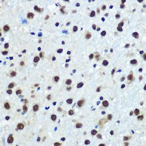 Immunohistochemistry analysis of paraffin-embedded rat brain using Anti-hnRNP K Antibody [ARC0512] (A307298) at a dilution of 1:100 (40X lens). Perform microwave antigen retrieval with 10 mM PBS buffer pH 7.2 before commencing with IHC staining protocol