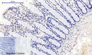 Immunohistochemical analysis of paraffin-embedded human colon tissue using Anti-JAK1 (phospho Tyr1022) Antibody at 1:200 (4 °C overnight). Negative control was secondary Antibody only