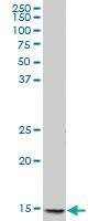 Anti-PPBP Mouse Polyclonal Antibody