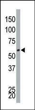 Anti-DYRK4 Rabbit Polyclonal Antibody (APC (Allophycocyanin))