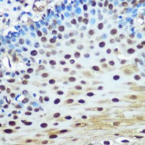 Immunohistochemistry analysis of paraffin-embedded human esophageal using Anti-hnRNP K Antibody [ARC0512] (A307298) at a dilution of 1:100 (40X lens). Perform microwave antigen retrieval with 10 mM PBS buffer pH 7.2 before commencing with IHC staining protocol