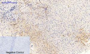 Immunohistochemical analysis of paraffin-embedded human liver tissue using Anti-JAK1 (phospho Tyr1022) Antibody at 1:200 (4 °C overnight). Negative control was secondary Antibody only