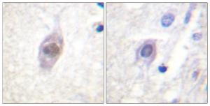 Immunohistochemical analysis of paraffin-embedded human brain using Anti-APC Antibody. The right hand panel represents a negative control, where the antibody was pre-incubated with the immunising peptide