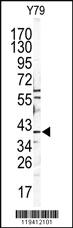 Anti-TYRP1 Rabbit Polyclonal Antibody