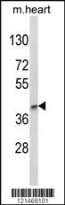 Anti-LMX1B Rabbit Polyclonal Antibody