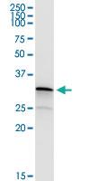 Anti-SSX2 Polyclonal Antibody Pair