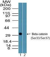 Anti-CTNNB1 Rabbit Polyclonal Antibody