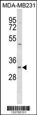 Anti-FAHD2B Rabbit Polyclonal Antibody (AP (Alkaline Phosphatase))