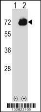 Anti-CTPS2 Rabbit Polyclonal Antibody (Biotin)