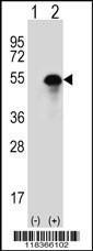 Anti-CA14 Rabbit Polyclonal Antibody